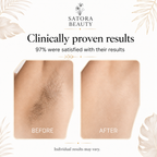Satora Beauty cyperus rotundus oil, applied twice daily to legs, underarms, arms and face